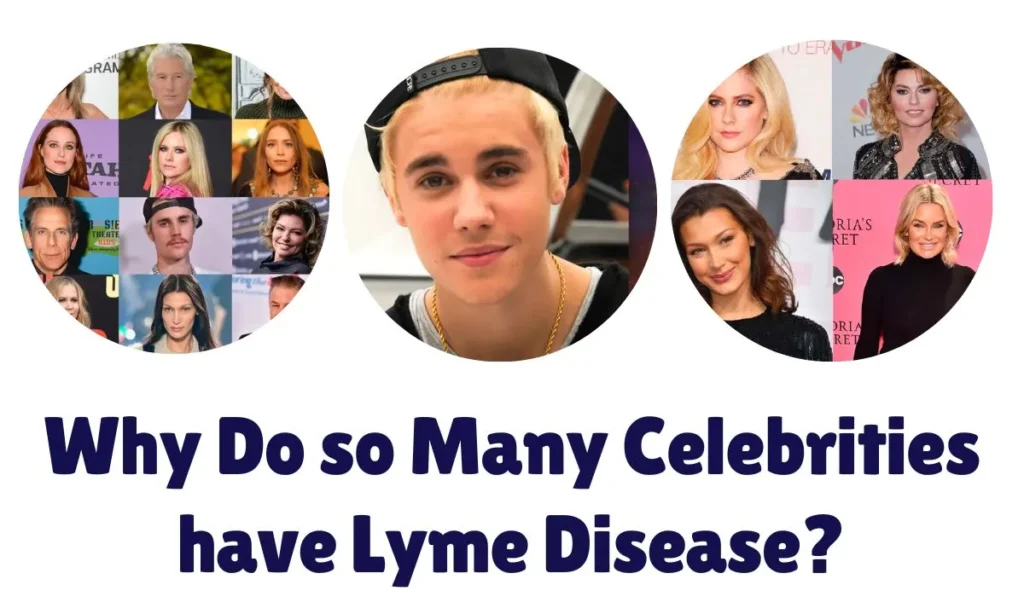 Why Do so Many Celebrities have Lyme Disease?